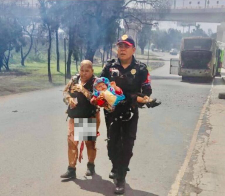 Abuelita que salvó a su nieta de ser calcinada, lucha por su vida en Hospital de La Paz