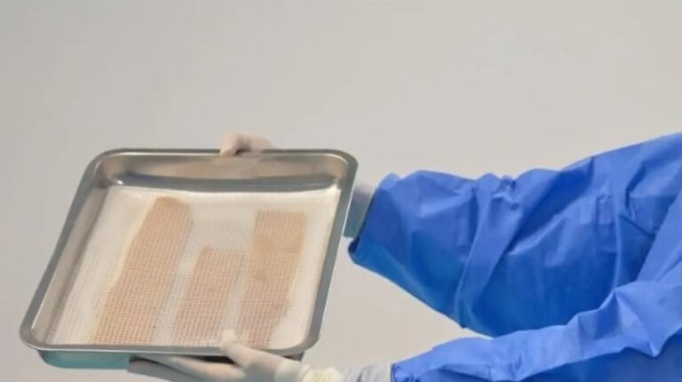 Banco de Tejidos del Edomex dona tejido amniótico para pacientes quemados en Iztapalapa