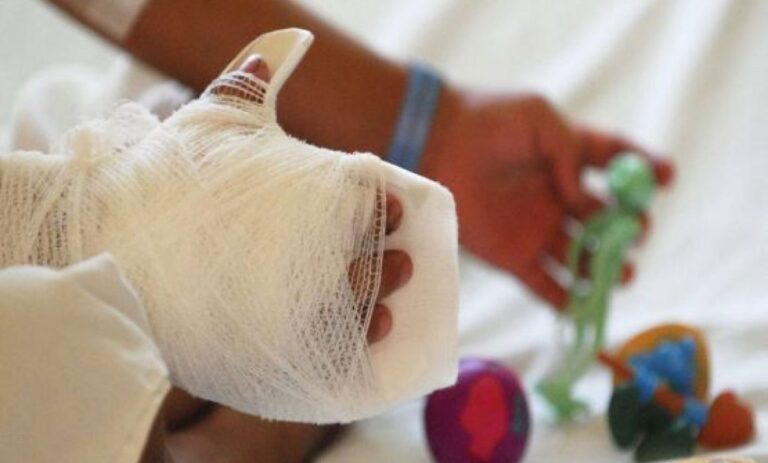 Implementa Edomex Código Quemados para salvar vidas mediante atención