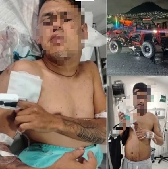 Balean a dos hombres en la México-Pachuca; agresores intentaban despojarlos de un Razer